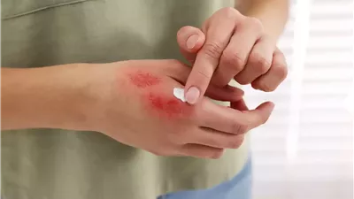 إصابة مدرس بجروح وخدوش باليد على يد طالب عقب أداء الامتحان بأوسيم