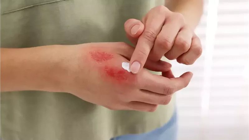 إصابة مدرس بجروح