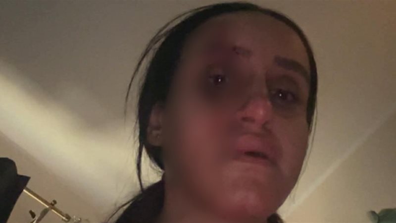  محاكمة زوج اعتدى