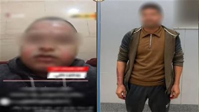 تحقيقات النيابة في واقعة حروق عامل بمحل حلويات بالبساتين