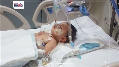 استغاثة أسرة طفل بالفيوم لعدم توافر غسيل كلوي.. والصحة: نقلناه للعلاج الفوري