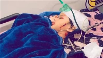 نهش رأسه.. كلب ضال يعقر صغيرا عمره 3 سنوات بمدينة رأس سدر في جنوب سيناء