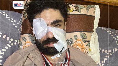 بعد خروجه من العمليات.. بطل الجمهورية في «الريست» يروي تفاصيل الاعتداء عليه 