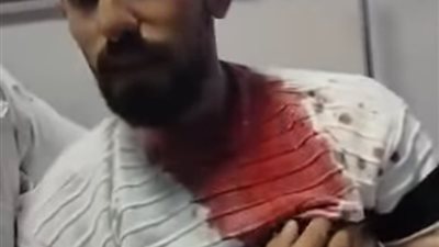 إصابة فنيي أشعة في اعتداء بسلاح أبيض داخل مستشفى ديروط بأسيوط