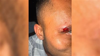 هجوم على سياح إسرائيليين في جزيرة كو ساموي بتايلاند من قبل فرنسيين