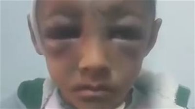 10 جنيهات تتسبب فى تعذيب طفل من والده  في  المحلة بمحافظة الغربية 