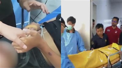 وفاة طفل إندونيسي أجبرته زوجة والده على شرب الماء المغلي 