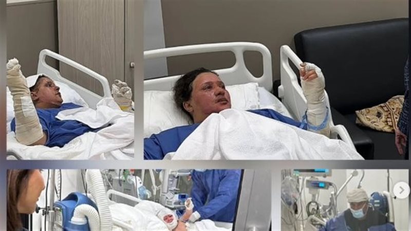 انفجار أنبوبة بوتاجاز