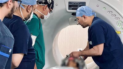 نجاح أول عملية زرع مضخة باكلوفين لعلاج التشنج العضلي الشديد بالأقصر