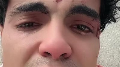 فيديو مؤثر.. صانع محتوى يطالب بحقه بعد الاعتداء عليه من 10 أشخاص|شاهد 