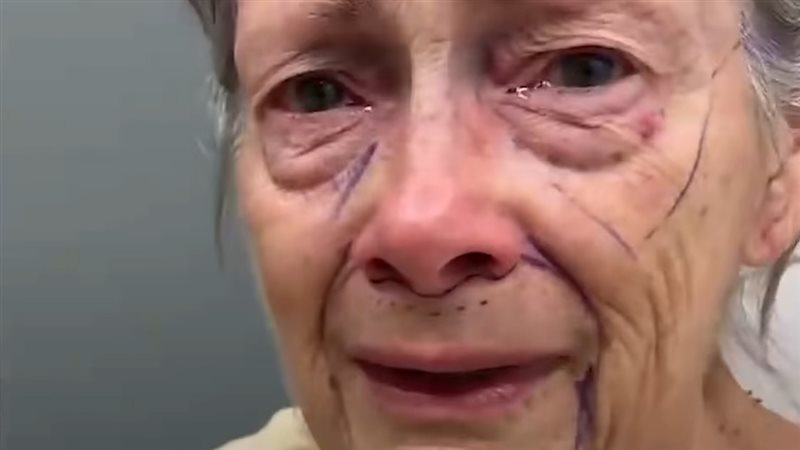 المرأة قبل التجميل