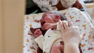 تعرفي على مرض هيرشسبرونج وأهم أعراضه عند المواليد الجدد 