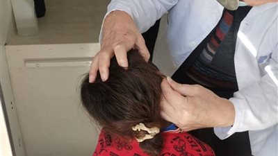 غدا..  قافلة طبية مجانية للرمد بحي الأربعين بمحافظة السويس 