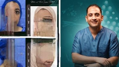 من الألم إلى الأمل.. نجاح طبي مصري يعيد فتاة غزة إلى الحياة الطبيعية| تفاصيل