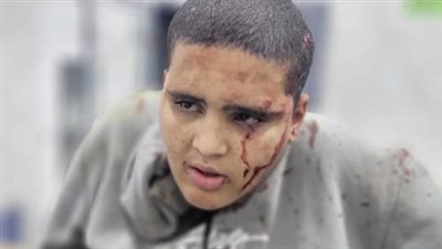 بعد سقوطه من القطار.. نقل طفل من ذوي الاحتياجات لمستشفي بالمنوفية