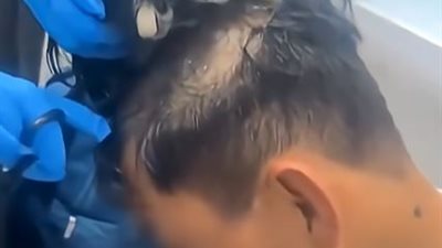 كوكايين داخل باروكة يسقط مهربا في كولومبيا بأيدي الشرطة.. تفاصيل