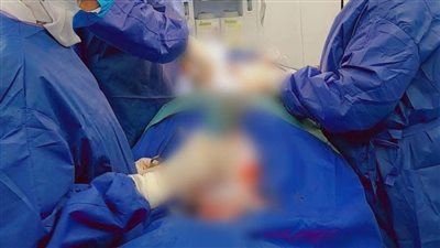 نجاح جراحة دقيقة لتثبيت فقرات العمود الفقري لفتاة بمستشفى القنطرة غرب المركزي