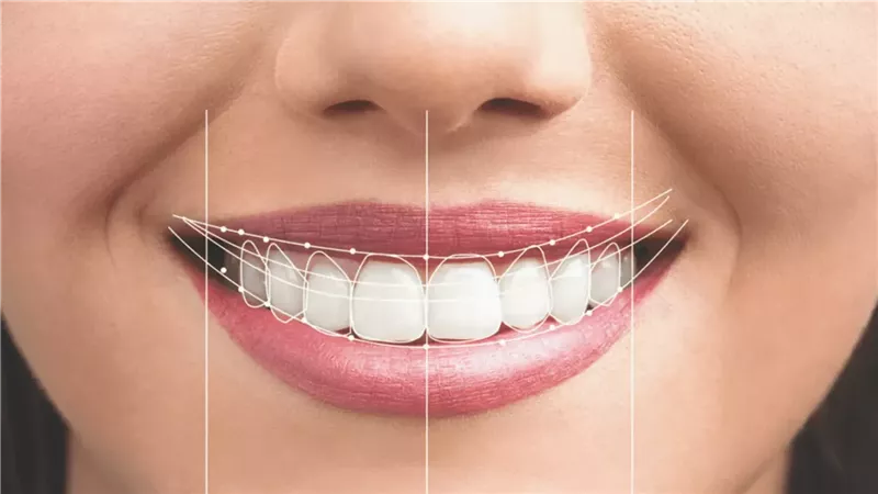 اعرف صحة أسنانك