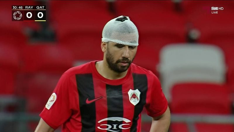 إصابة تريزيجيه في