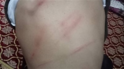     واقعة ضرب طالب تشعل الغضب.. مطالب بالتحقيق في مدرسة بالشرقية 