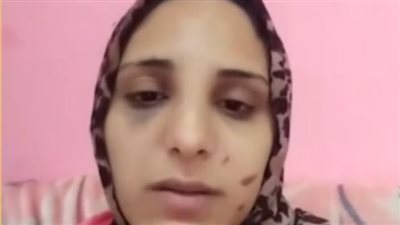 سيدة تستغيث بالنجدة بعد تعرضها للضرب من زوجها بسبب سيجارة حشيش