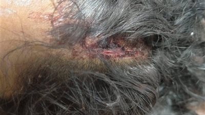 عرض طالبة «سميرة موسى» على الطب الشرعي بعد واقعة الاعتداء عليها بالإسكندرية