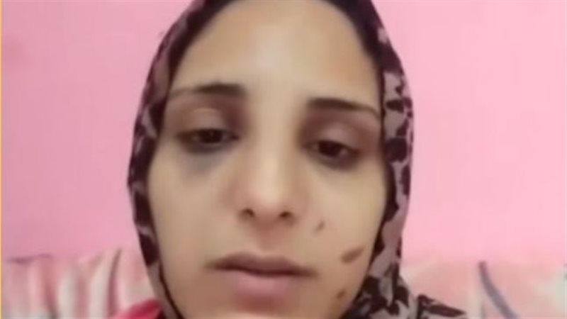 سيدة تصرخ بعد تعرضها