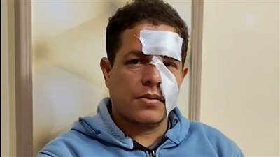 طالب إعدادي يسبب لمعلم بالدقهلية 15 غرزة.. وهاشتاج “نطالب بحق المعلم