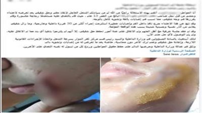 بسبب لهو الأطفال.. ضبط طالب لاعتدائه على زميله بقطعة زجاج في البحيرة