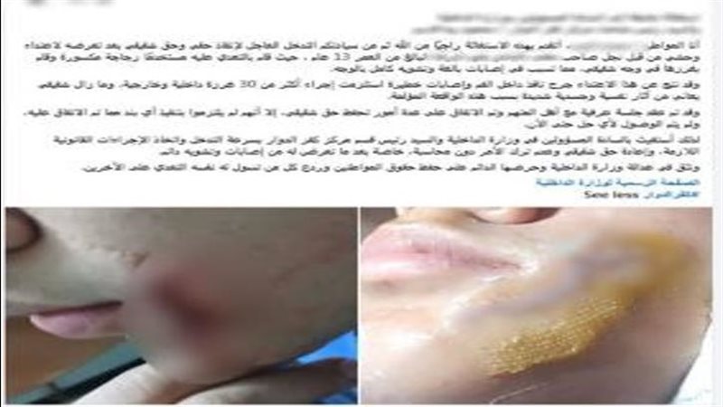 المجني عليه