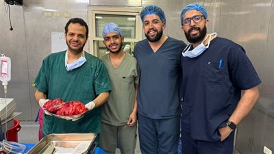فريق جراحة قصر العيني ينجح في استئصال ورم نادرمن صدر مريض ستيني