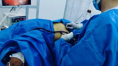 الشرقية تعلن نجاح أول جراحة متقدمة لاستئصال الكلية اليسرى والمرارة بالمنظار
