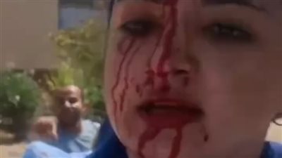 حبس متهم بالتعدي على طليقته ووالدتها وشقيقتها بشبين القناطر بالقليوبية