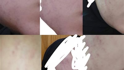 اتهامات صادمة لطبيب أثناء الولادة تثير الجدل وصاحبة الرواية: «كان بيضربني بعنف وأنا بولد»