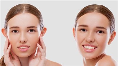 أنواع عمليات تجميل الأذن.. أسباب نفسية وطبية لإجرائها 