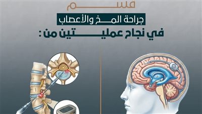 عمليتان دقيقتان تنهيان معاناة مريضين داخل مستشفى طيبة التخصصي بالأقصر 