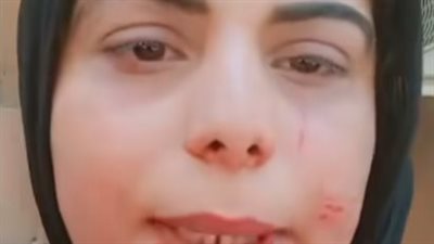 «مباحث بنها» تكشف الحقيقة.. نهاية أزمة المريضة والممرضة بمستشفى جامعة بنها 