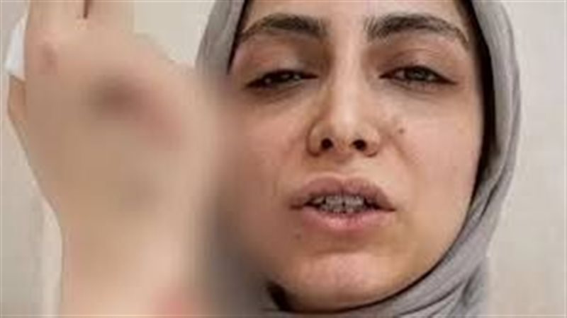 طبيبة الاسنان المعتدى