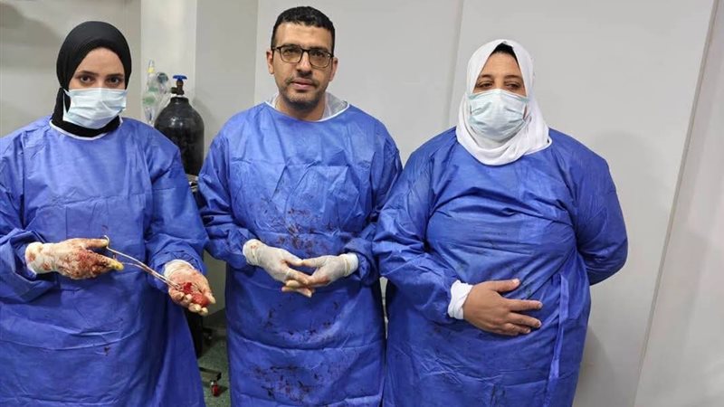 نجاح عمليتين معقدتين