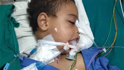 غيبوبة 15 يومًا انتهت بمأساة.. أسرة طفل شبين الكوم تروي تفاصيل وفاته  