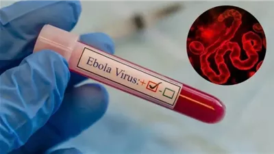 إيبولا يجتاح الكونجو الديمقراطية.. أكثر من 3500 إصابة خلال أشهر