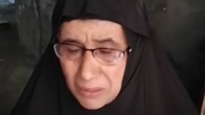 جارها سيبهم عليها.. سيدة ضحية عقر الكلب بالغربية: الكلاب أكلت الطحال والمعدة