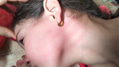حبس معلمة ضربت طفلة في الشرقية.. القصة كاملة                                  