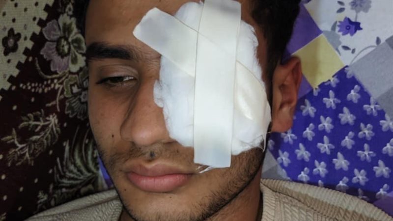 صورة المجنى عليه