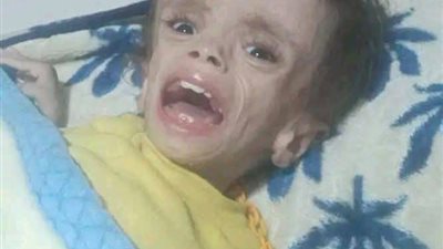 محافظ سوهاج يستجيب لاستغاثة الطفل 