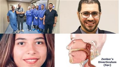خلال نصف ساعة.. تقنية جديدة تنجح في علاج جيب المريء بمستشفيات جامعة بني سويف