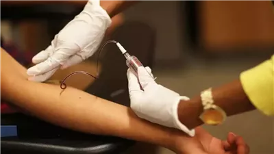 وفاة شخص وإصابة أكثر من 200 شخصا بمرض السالمونيلا في بريطانيا 