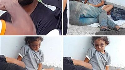 عينها وارمة وملامحها تثير الجدل.. استغاثة لإنقاذ طفلة من رجل بالإسكندرية