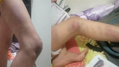 تعذيب طفلة وأخيها داخل كُتاب في الدقهلية: 