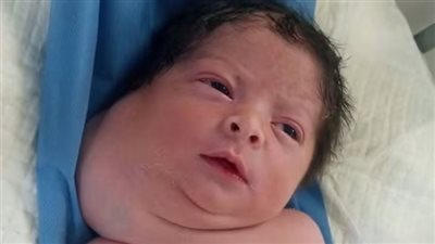 «ناصر لازم يسافر».. مناشدة عاجلة لإنقاذ رضيع فلسطيني يواجه خطر الاختناق